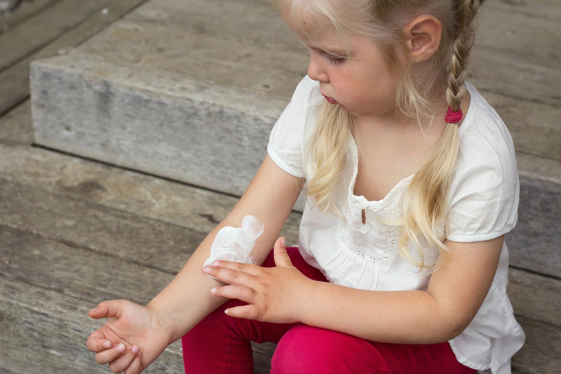 kid suffering with dry skin